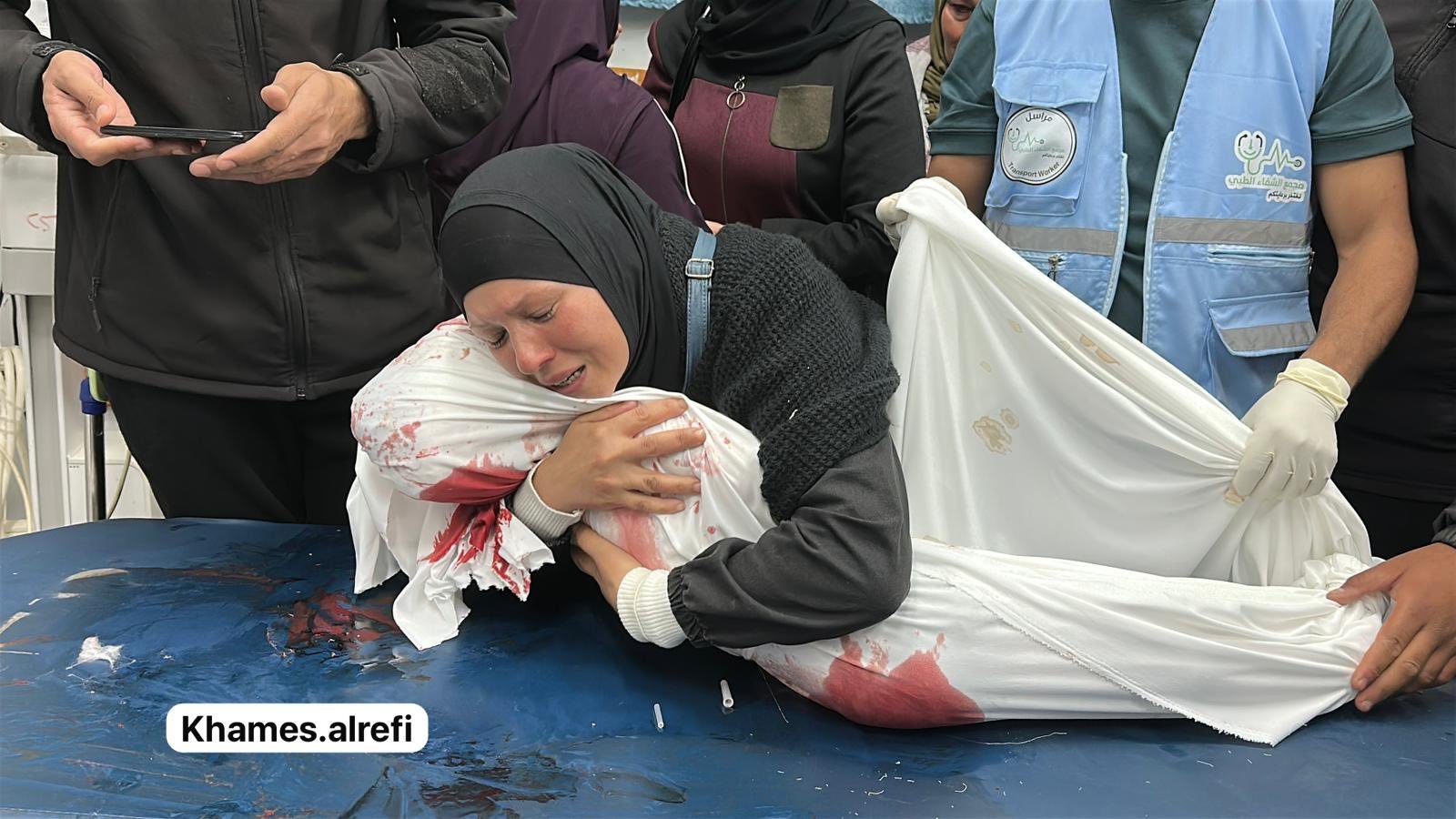 استشهاد طفل متأثرًا بإصابته برصاص الاحتلال شمال غزة
