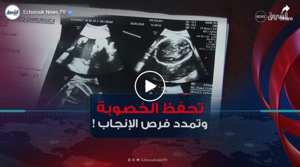 تجميد البويضات .. أمل جديد لحفظ الخصوبة وتمديد فرص الإنجاب