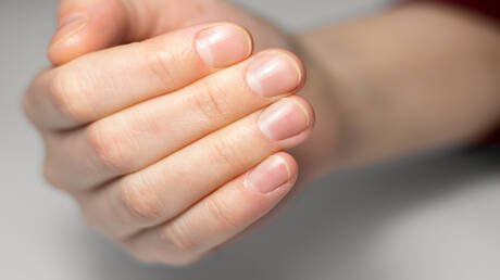 تغير بسيط في الظفر قد يكون علامة على مشكلات صحية كامنة